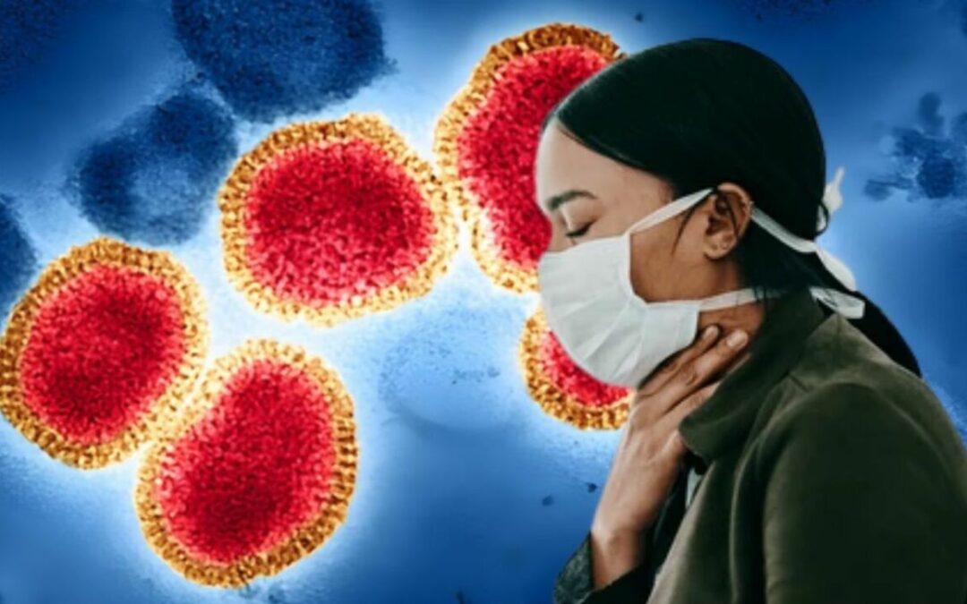 Gripe H3N2 en Palm Springs: Síntomas, Grupos Vulnerables y Riesgos de Pandemia